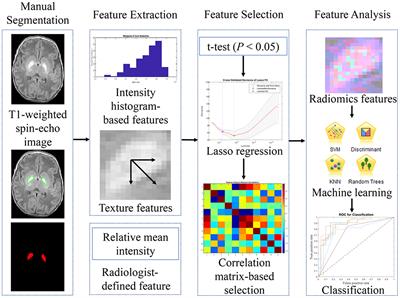 Machine Learning Assisted MRI Characterization for Diagnosis of Neonatal Acute Bilirubin Encephalopathy